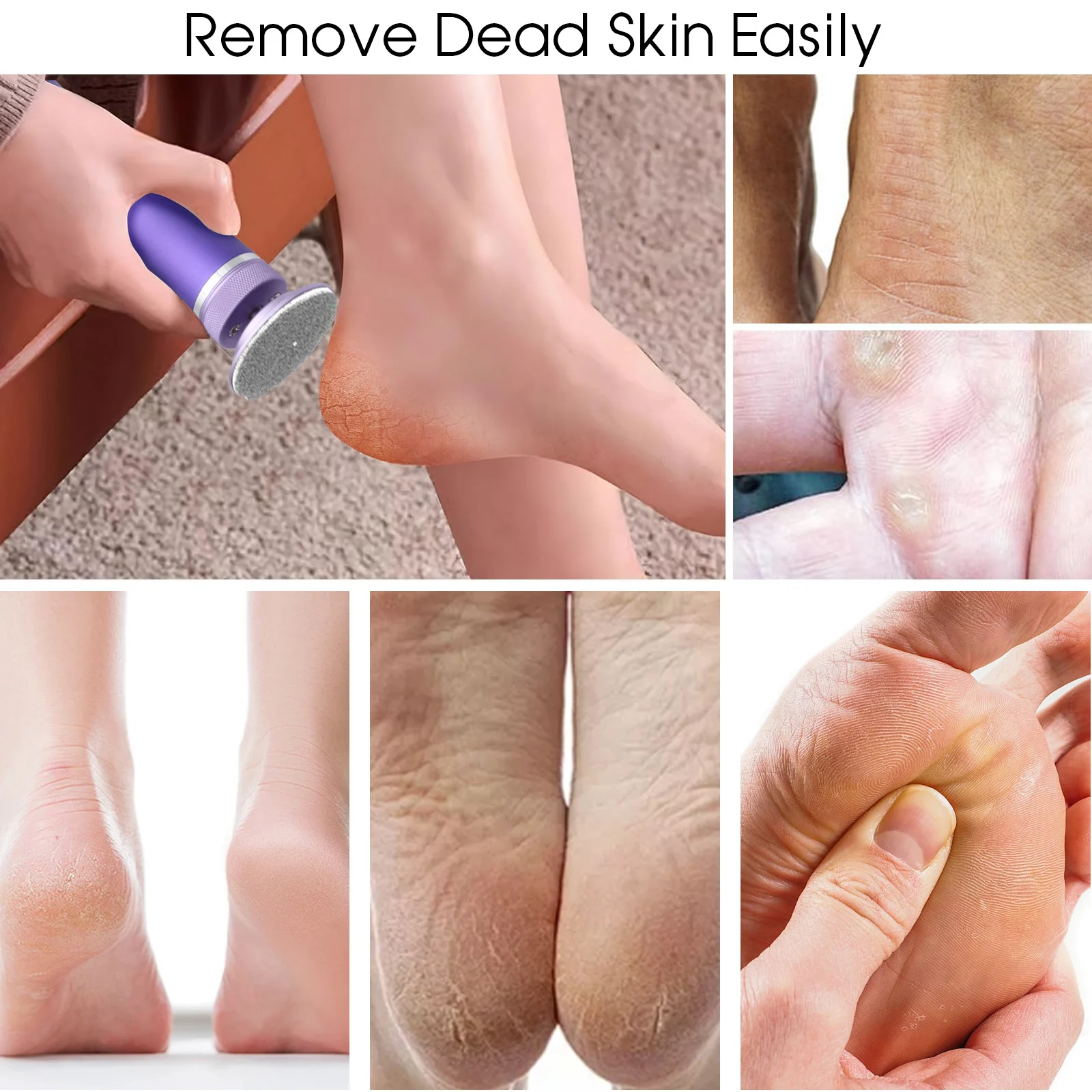 electric foot callus remover dead skin tool spu909386602267 desc 6